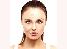 پیشگیری از پیری زودرس